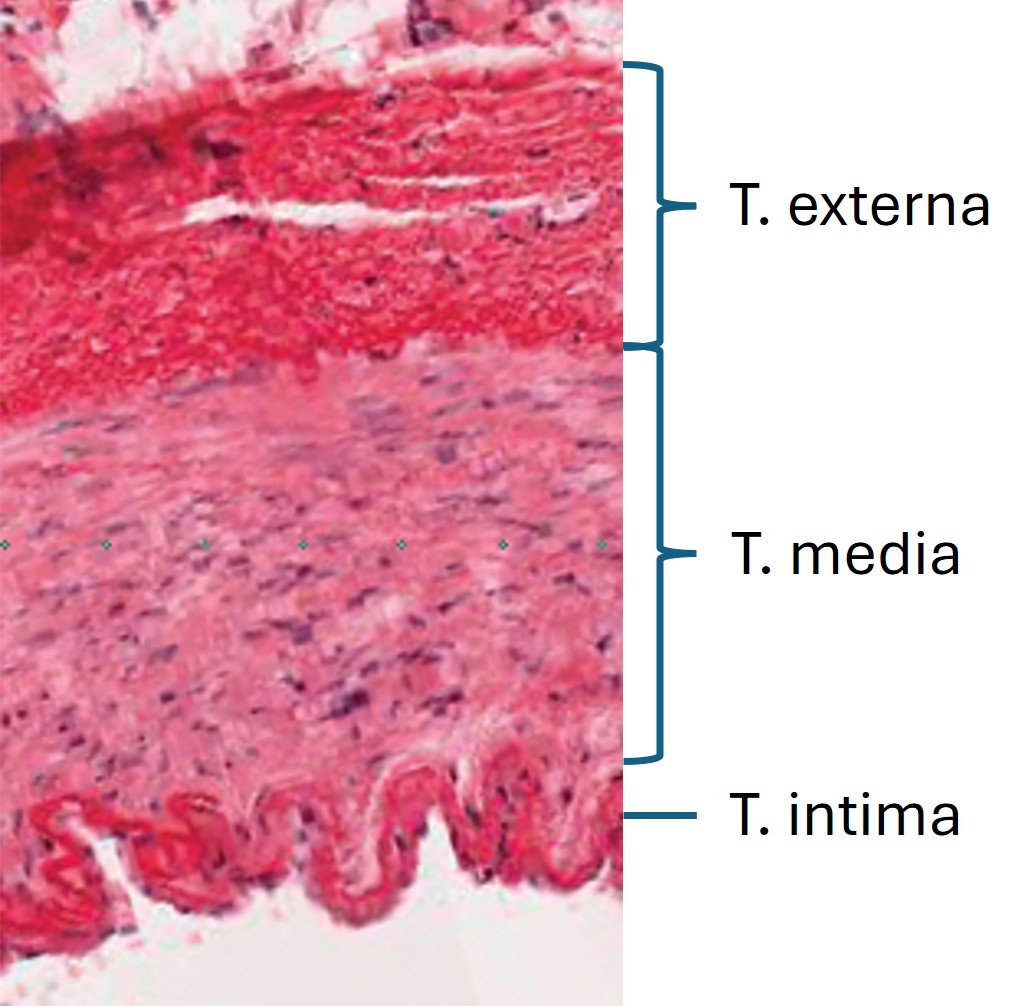 Aufbau Arterie